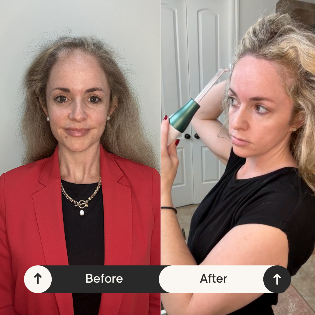 ApexGrow High Technology Hair Growth Wand 🇵ðŸ‡