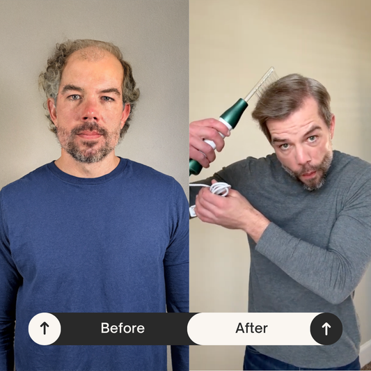 ApexGrow High Technology Hair Growth Wand 🇵🇭